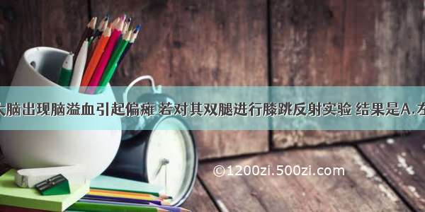 某人右侧大脑出现脑溢血引起偏瘫 若对其双腿进行膝跳反射实验 结果是A.左下肢有 右