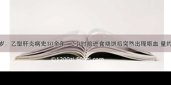 患者 女 50岁。乙型肝炎病史30余年。2小时前进食烧饼后突然出现呕血 量约800ml。查