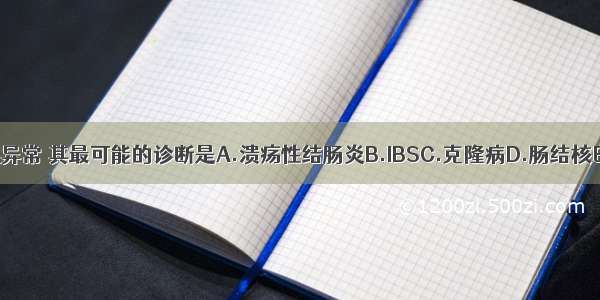 若检查均未见异常 其最可能的诊断是A.溃疡性结肠炎B.IBSC.克隆病D.肠结核E.细菌性痢疾